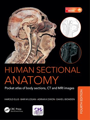 cover image of Human Sectional Anatomy